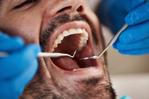 Best Tooth Infection Emergency Dentist  in San Rlos, CA